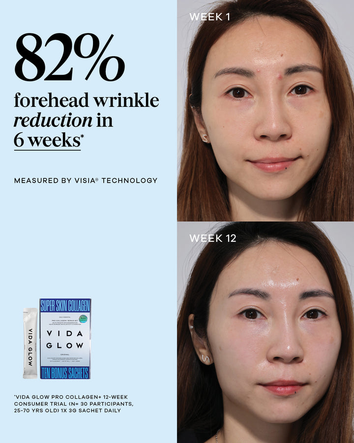 Vida Glow Pro Collagen+ Bonus Holiday Set
